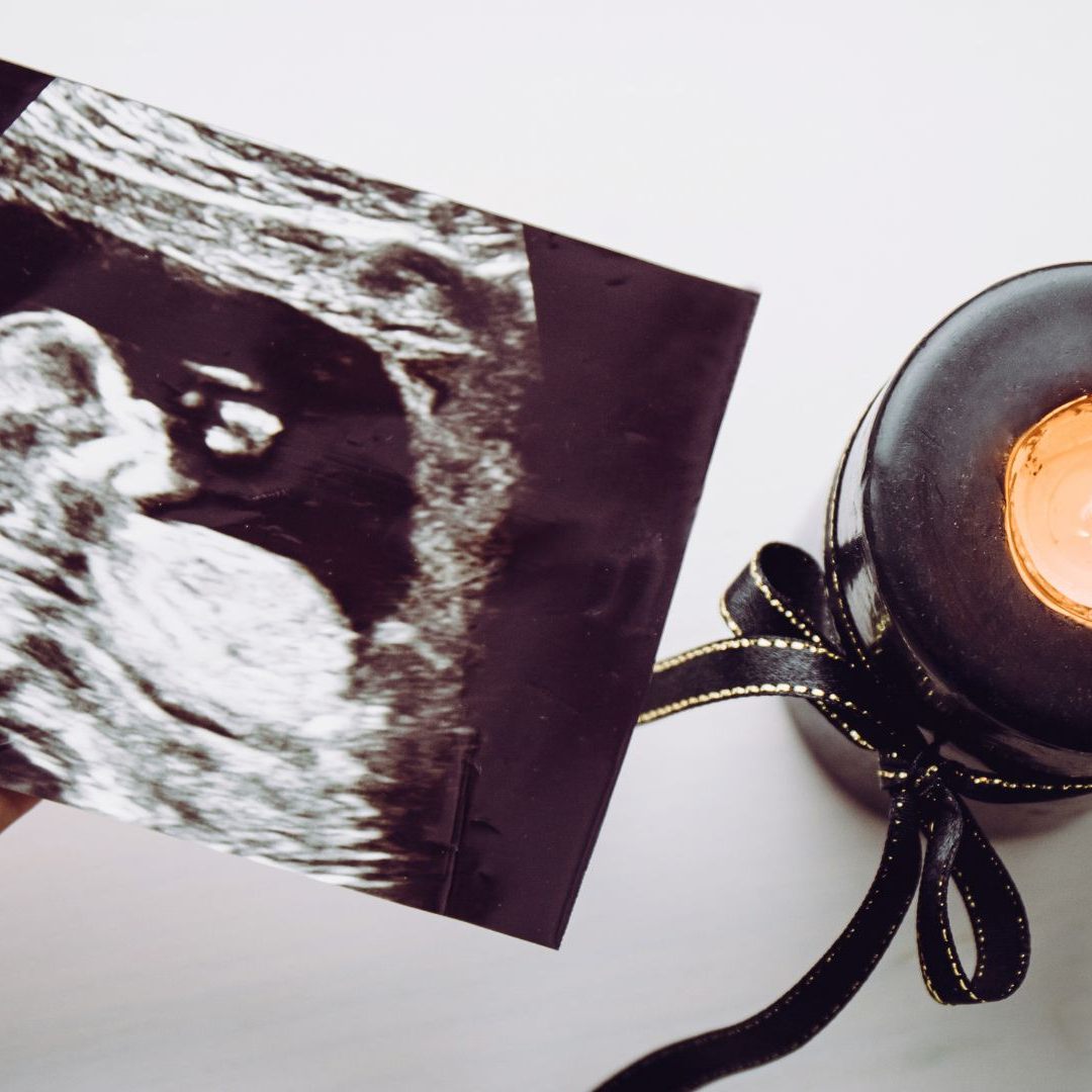 Symbolbild Fehlgeburt