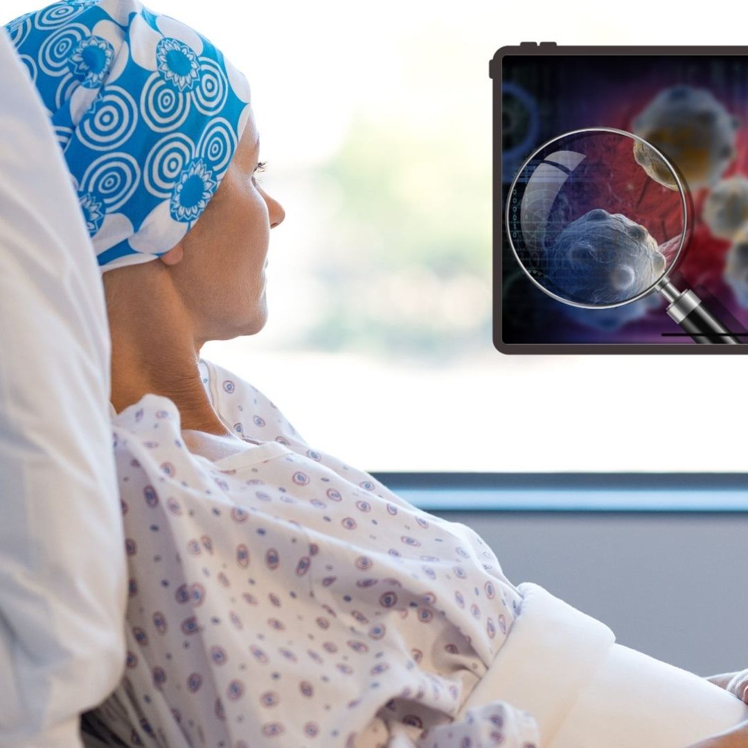 Krebsreport 2024 berichtet von gravierenden Folgen.