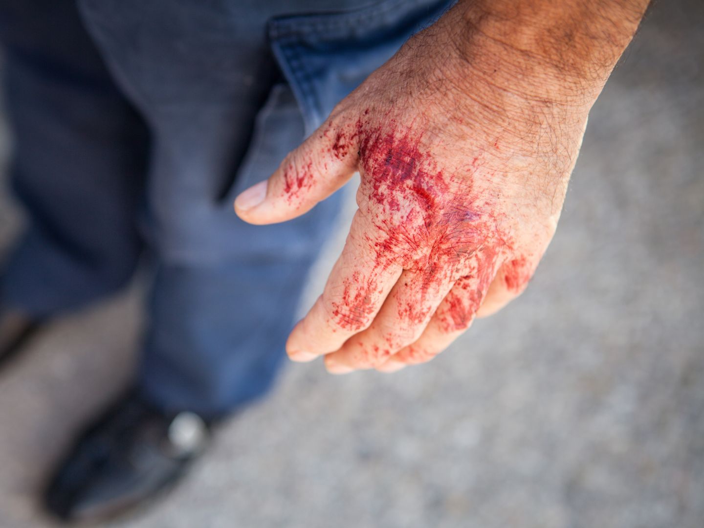 Das Pärchen hatte Blut an Händen und der Kleidung. Das Pärchen hatte Blut an Händen und der Kleidung.
