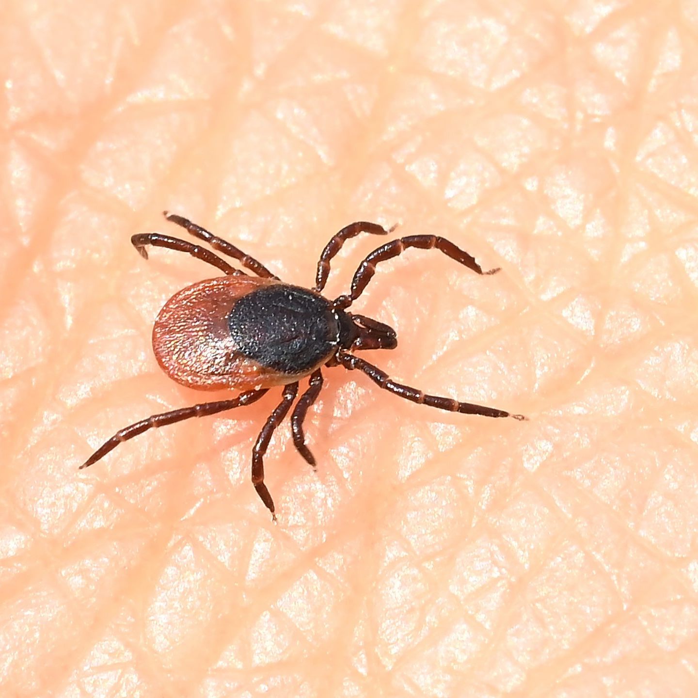 Die Zahl der hospitalisierten FSME-Erkrankten stieg 2024 weiter an.