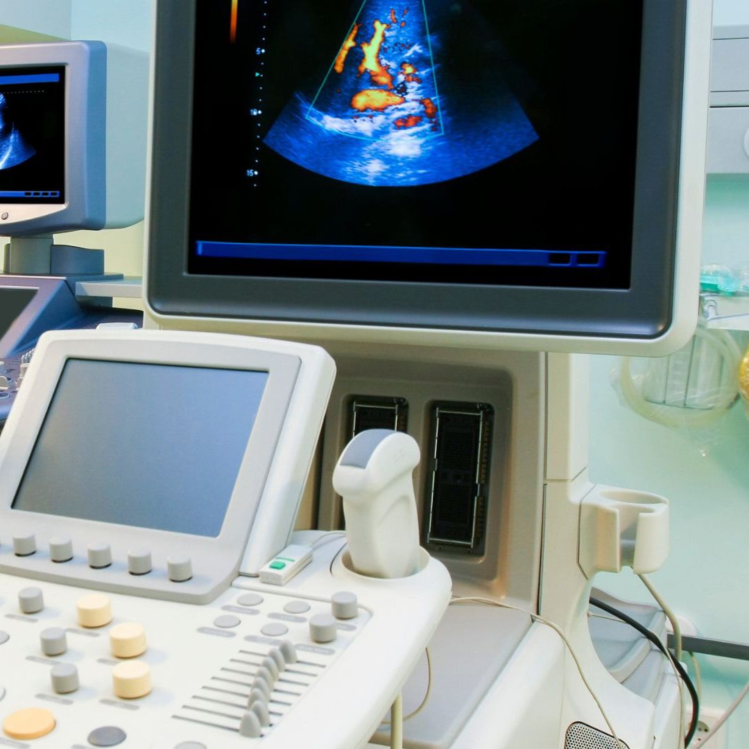 Die Feststellung eines Schlaganfalls bei Babys ist nun auch via Ultraschall möglich.