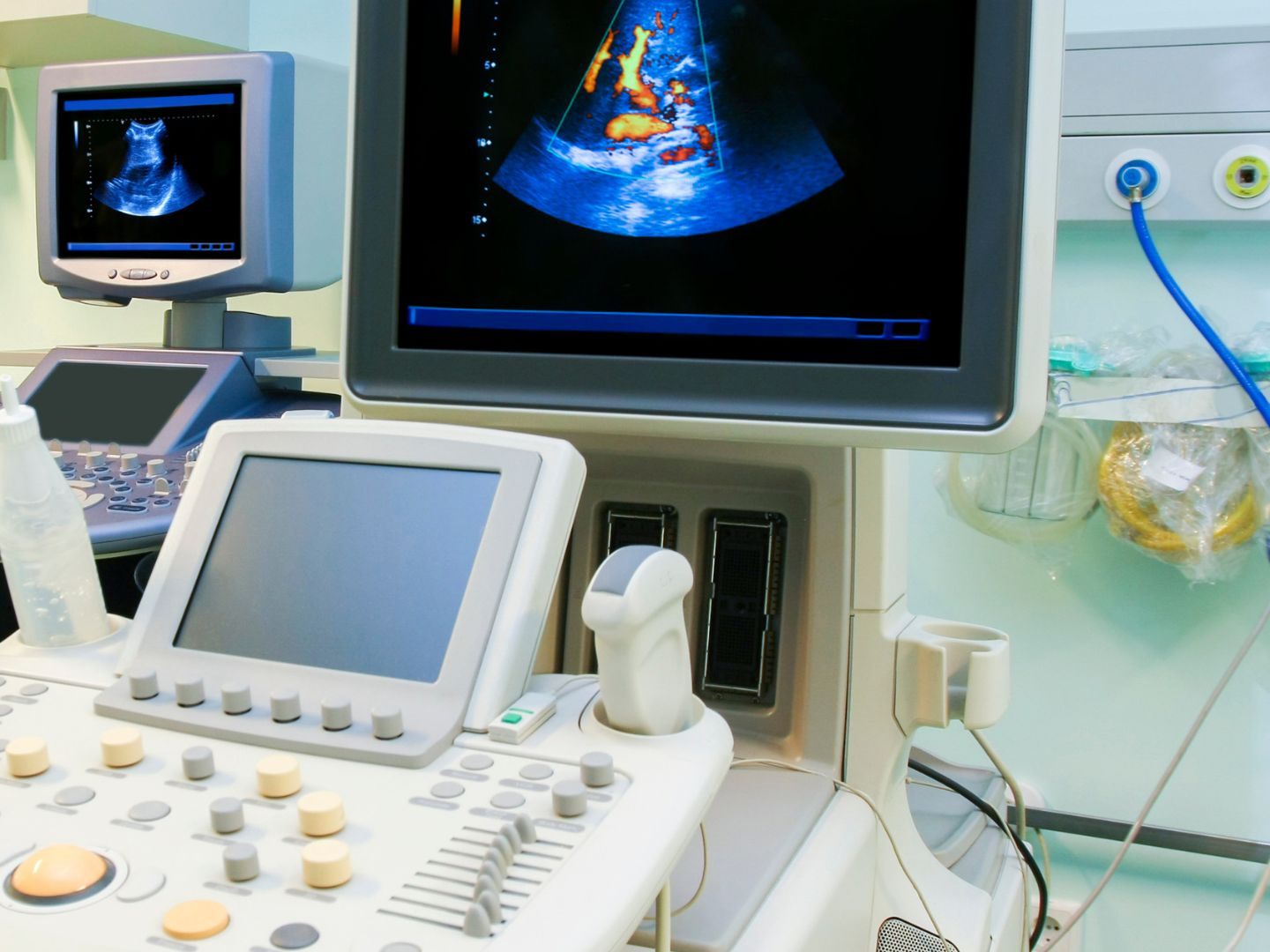 Die Feststellung eines Schlaganfalls bei Babys ist nun auch via Ultraschall möglich.