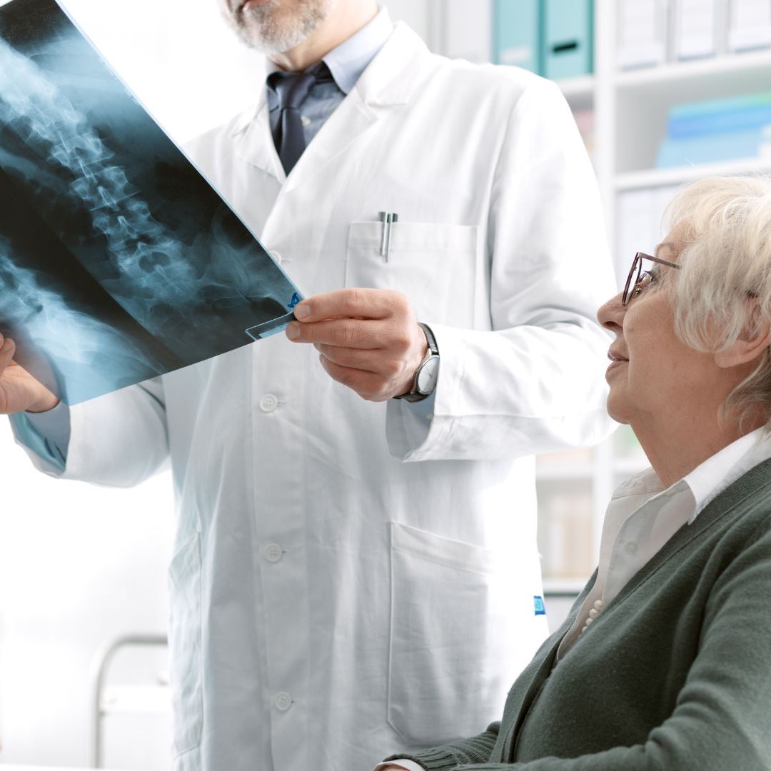 Die Behandlungslücke bei Osteoporose ist in Österreich größer als gedacht.