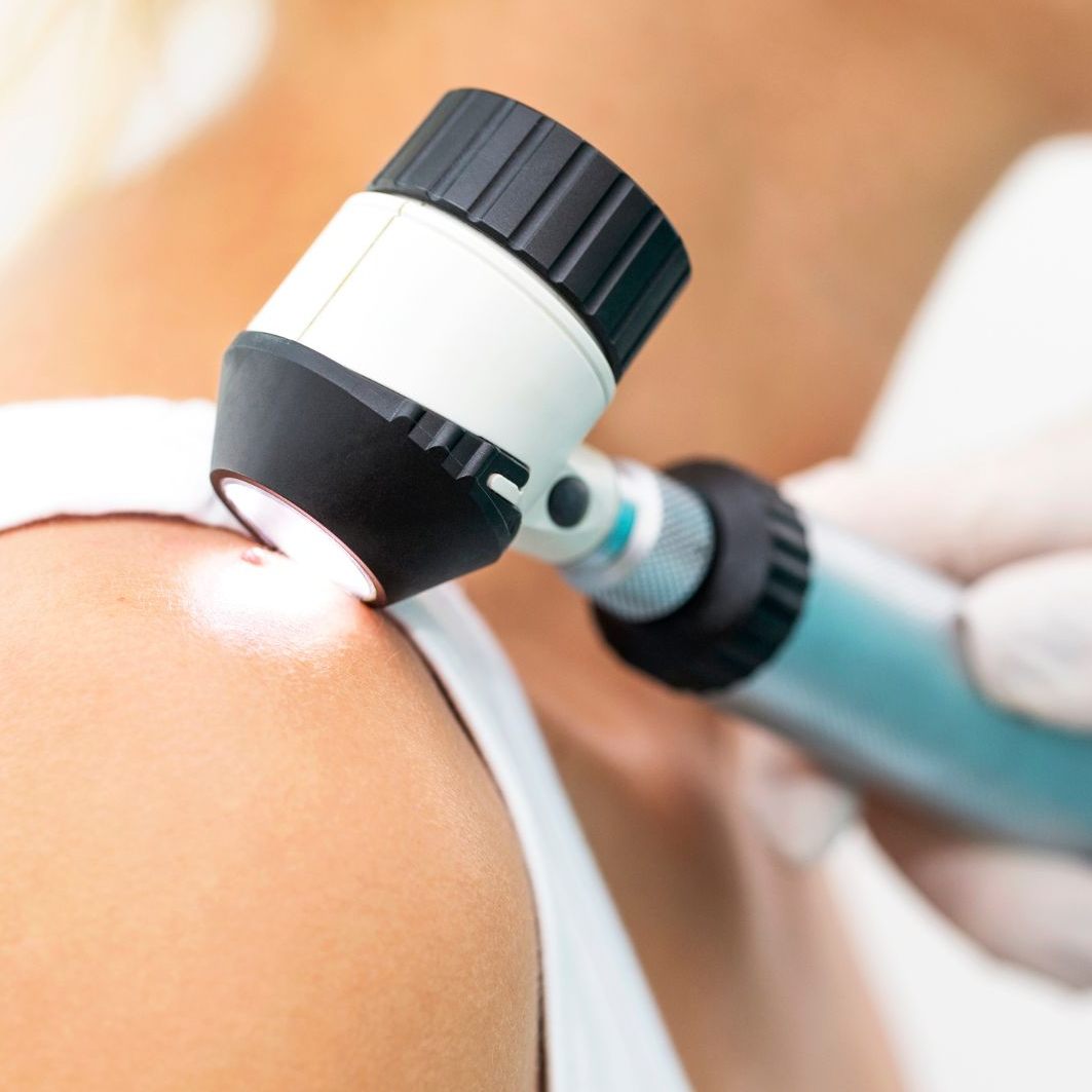 Weißer Hautkrebs ist seit 2024 als Berufskrankheit anerkannt.