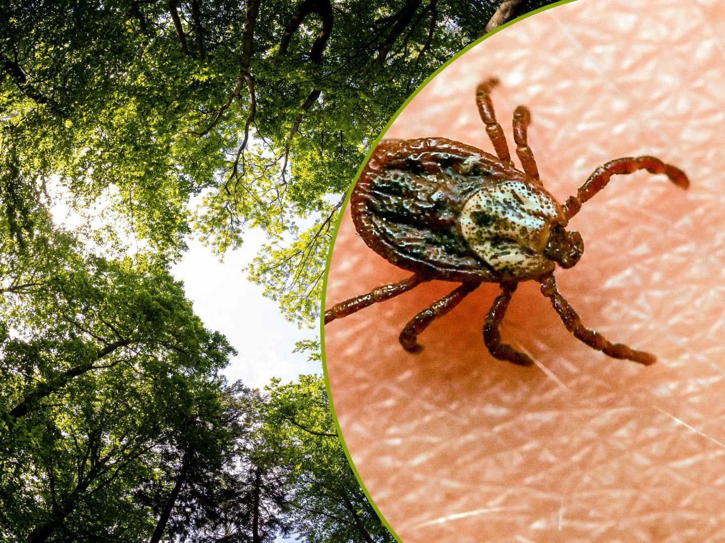 Die Gefahr von Zeckenbissen steigt bei milderen Temperaturen. Die Gefahr von Zeckenbissen steigt bei milderen Temperaturen.