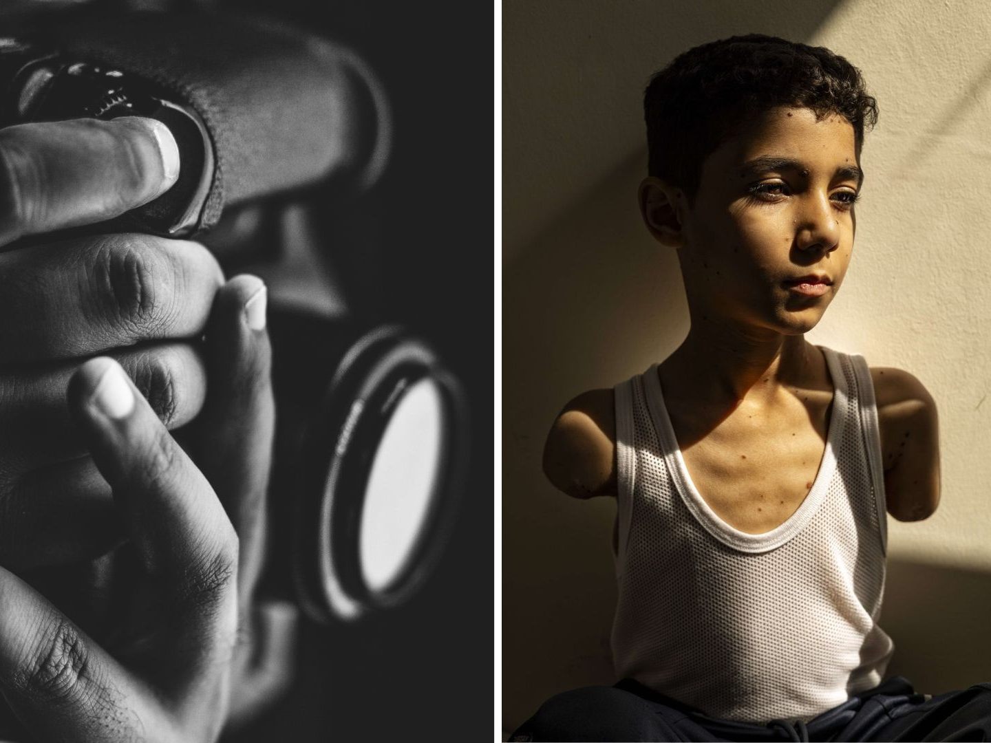 Fotografin Samar Abu Elouf überzeugte die Jury mit einem Foto des neunjährigen Mahmoud. Fotografin Samar Abu Elouf überzeugte die Jury mit einem Foto des neunjährigen Mahmoud.