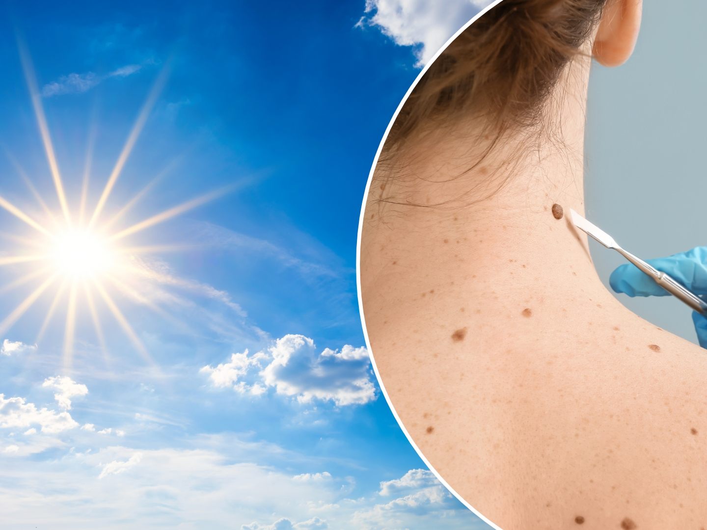 Die Klimakrise hat massive Auswirkungen auf die Gesundheit - u. a. auch auf die Haut. Die Klimakrise hat massive Auswirkungen auf die Gesundheit - u. a. auch auf die Haut.