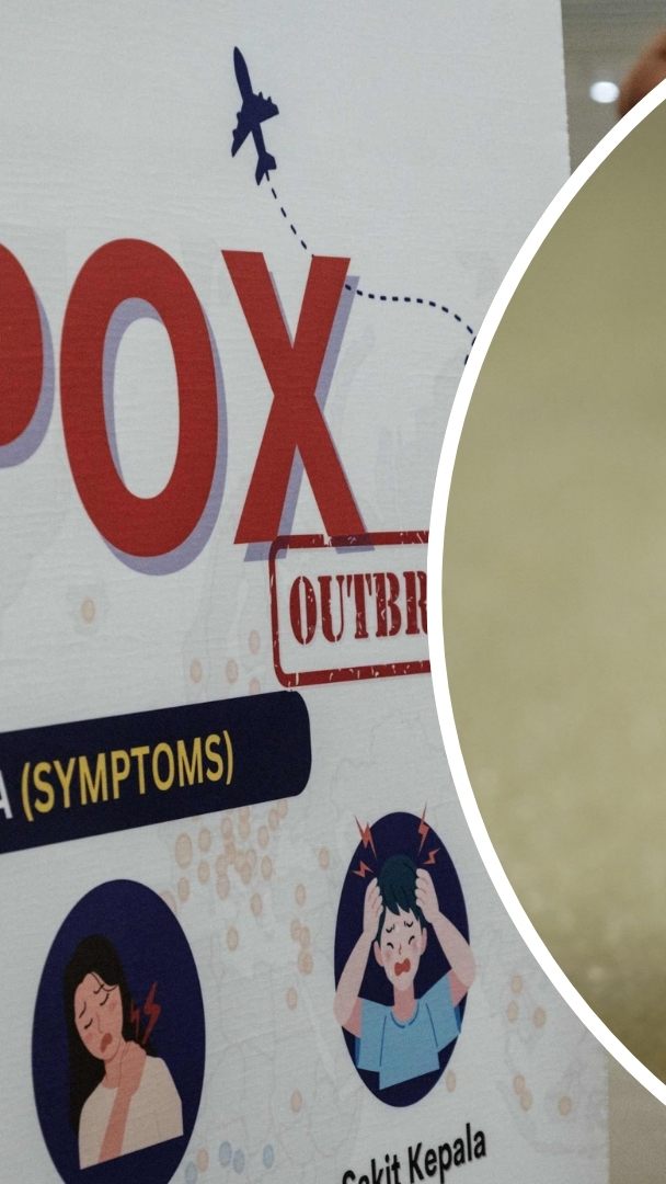 Schwache Gegenmaßnahmen lassen Epidemierisiko durch Mpox-Virus steigen.