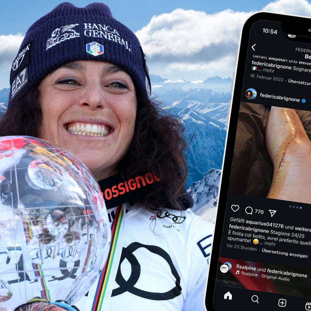 Federica Brignone zeigt nach ihrem Ski-Unfall eine auffällige OP-Narbe. Die 42 Stiche und eine ungewisse Genesung gefährden ihre Olympia-Teilnahme 2026.