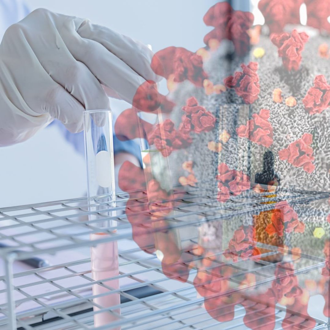 Das Protein Nsp1 hemmt bei einer Infektion mit einem Coronavirus die Produktion zelleigener Proteine.