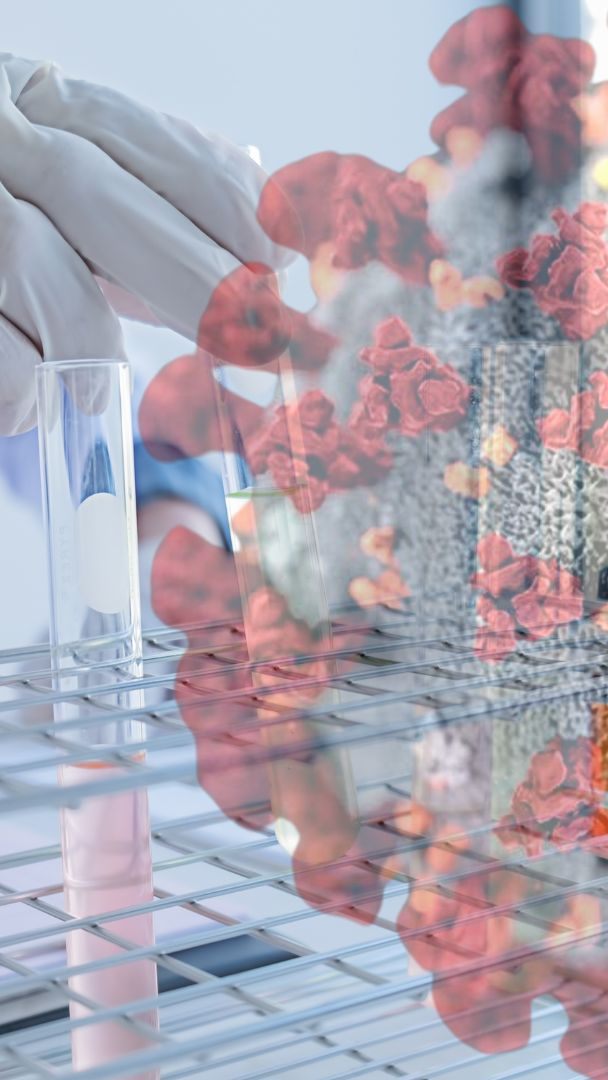 Das Protein Nsp1 hemmt bei einer Infektion mit einem Coronavirus die Produktion zelleigener Proteine.