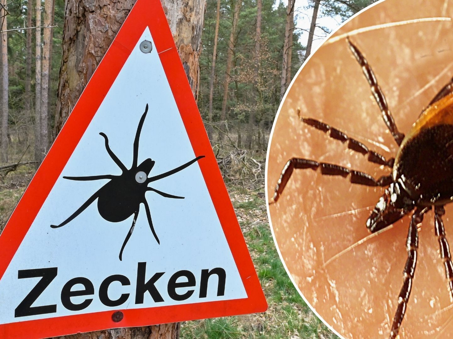 Gefährliche Zecken breiten sich in Österreich aus (SYMBOLBILD) Gefährliche Zecken breiten sich in Österreich aus (SYMBOLBILD)