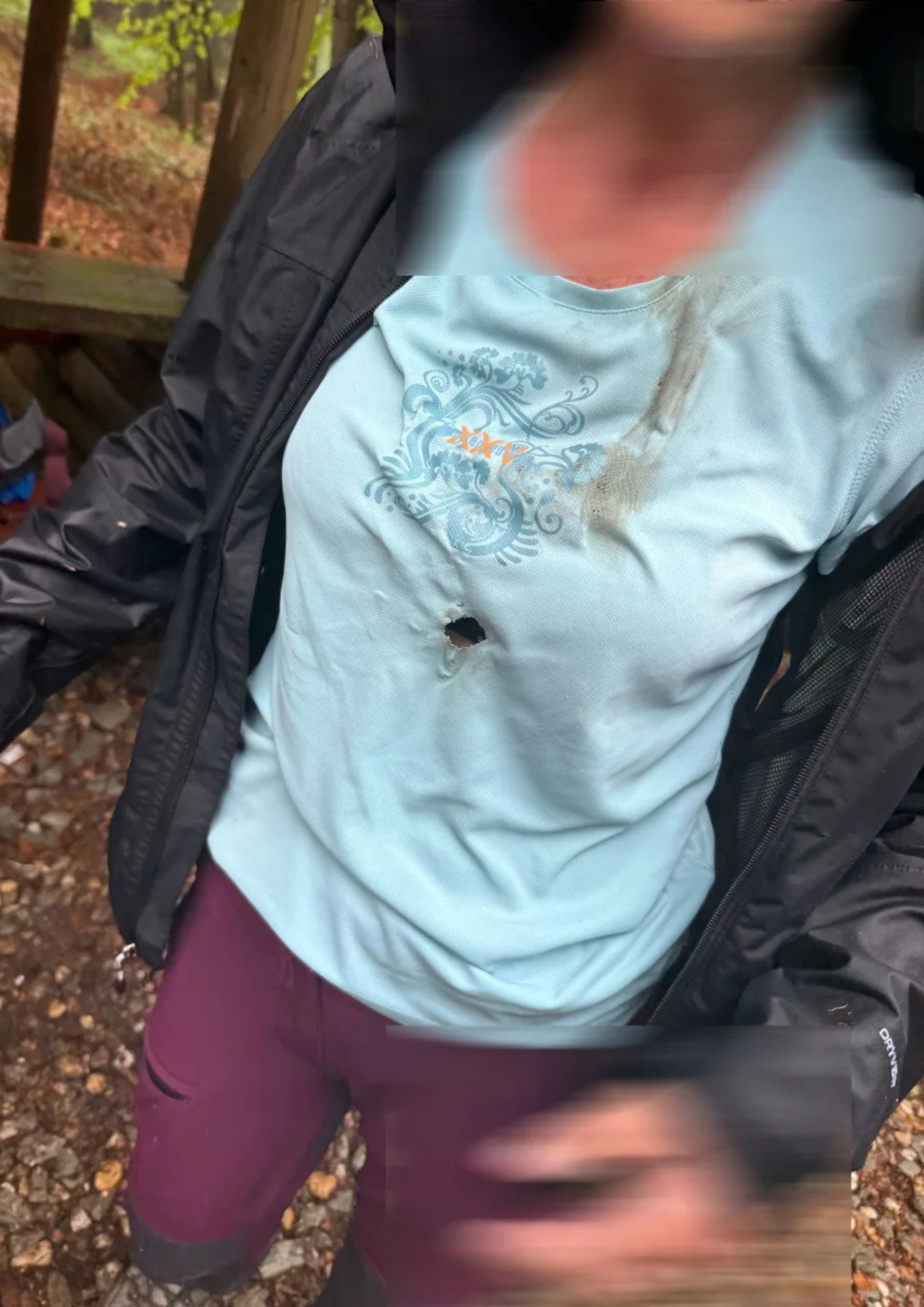 Die Frau wurde mitten in der Brust vom Blitz getroffen.