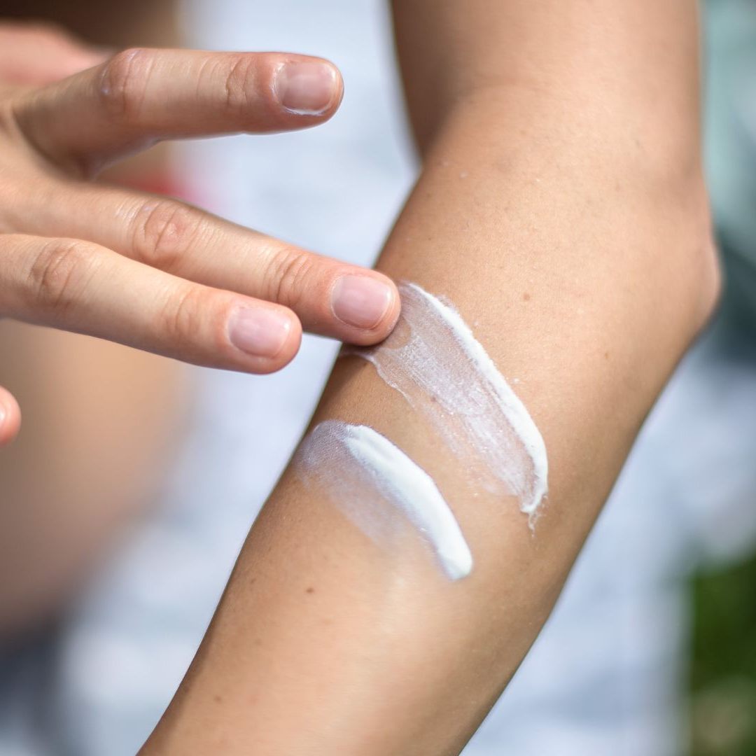 Alte Sonnencreme kann den UV-Schutz verlieren und zur Sonnenfalle werden.