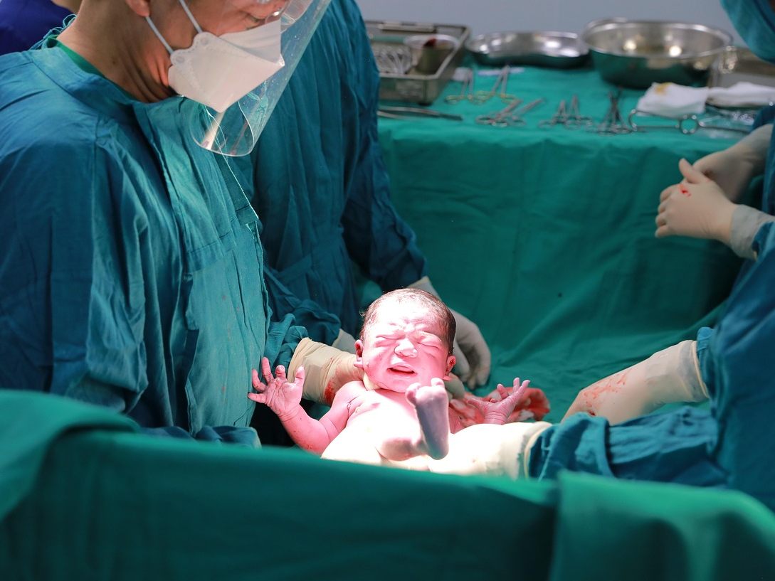 Ein Drittel der Babys in Österreich kommt per Kaiserschnitt. Ein Drittel der Babys in Österreich kommt per Kaiserschnitt.