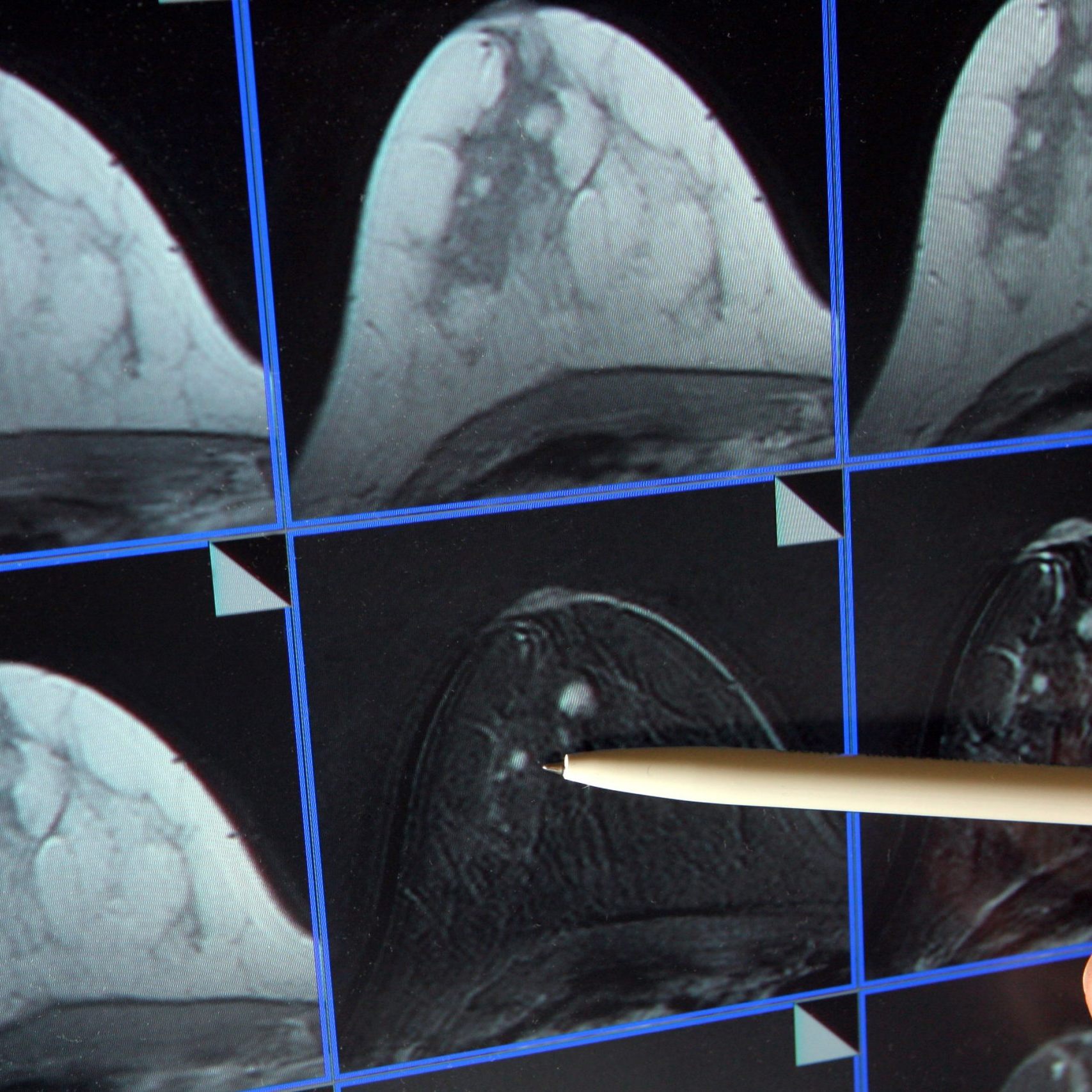 Durch frühzeitiges Erkennen der Erkrankungen können die Kosten deutlich gesenkt werden.