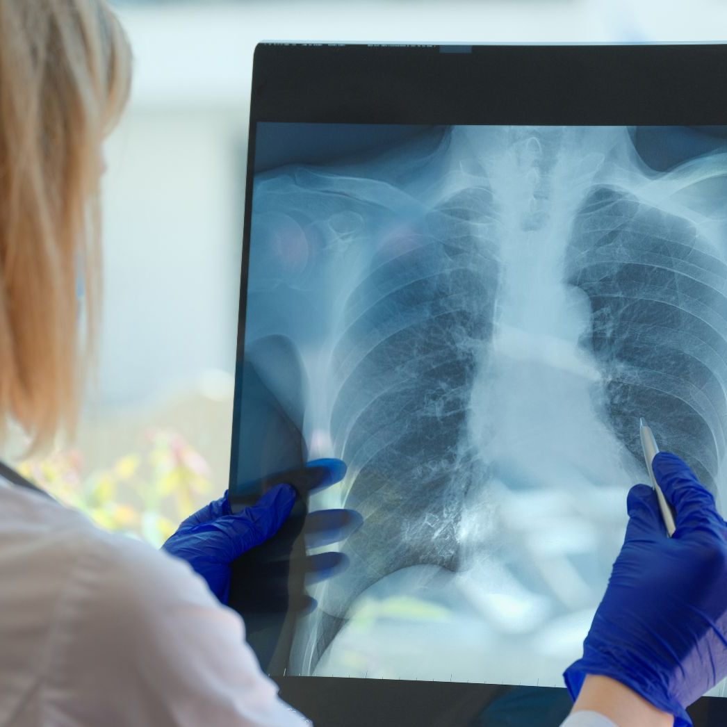 22 von 27 EU-Staaten mit Früherkennungsprogrammen - Österreich als "weißer Fleck".