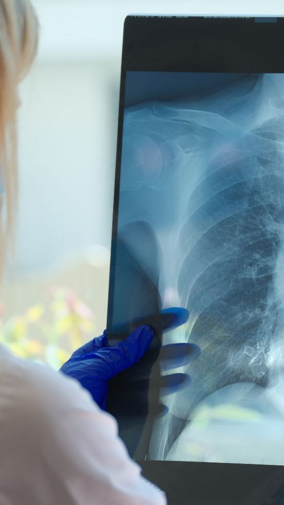 22 von 27 EU-Staaten mit Früherkennungsprogrammen - Österreich als "weißer Fleck".