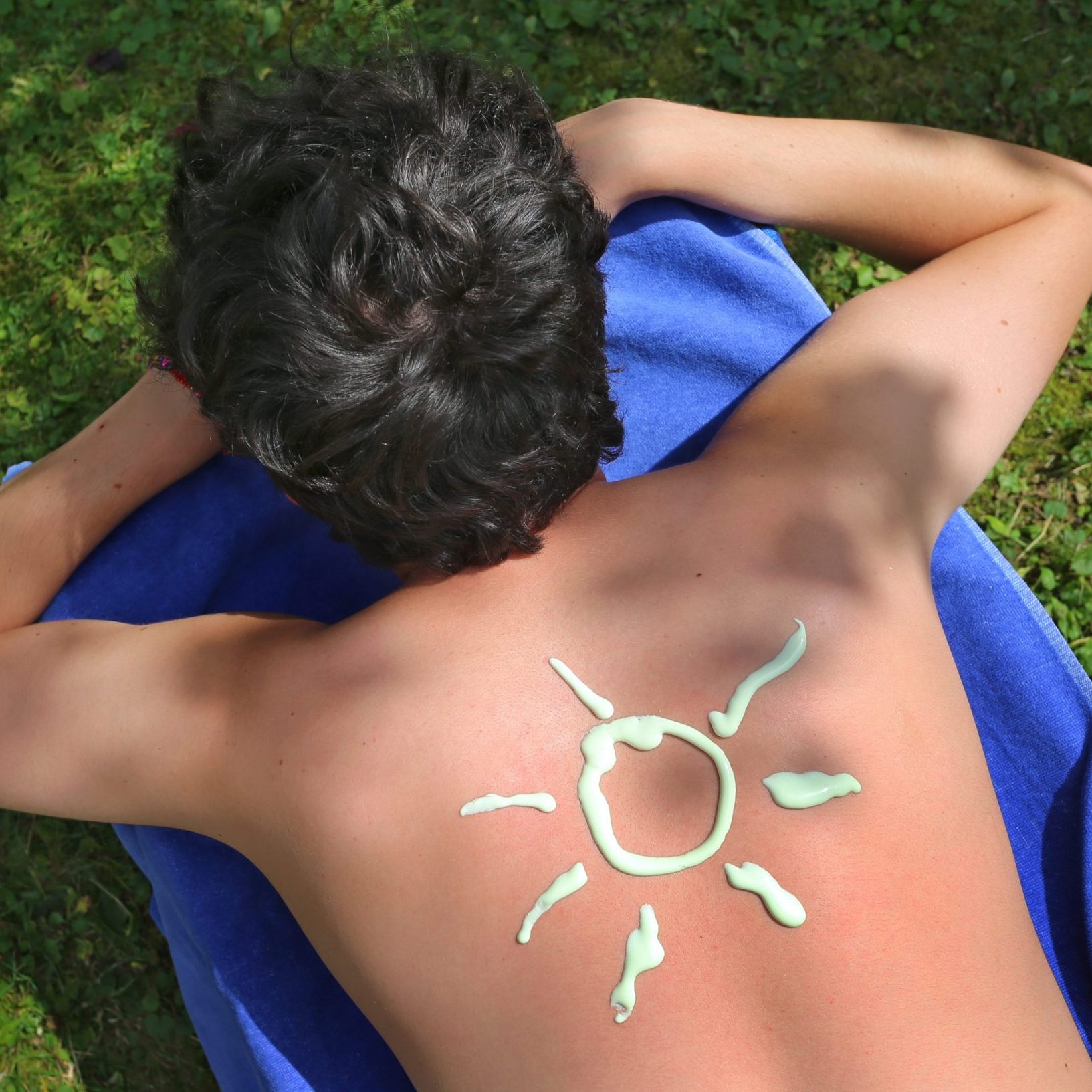 Diese Hausmittel helfen gegen Sonnenbrand.