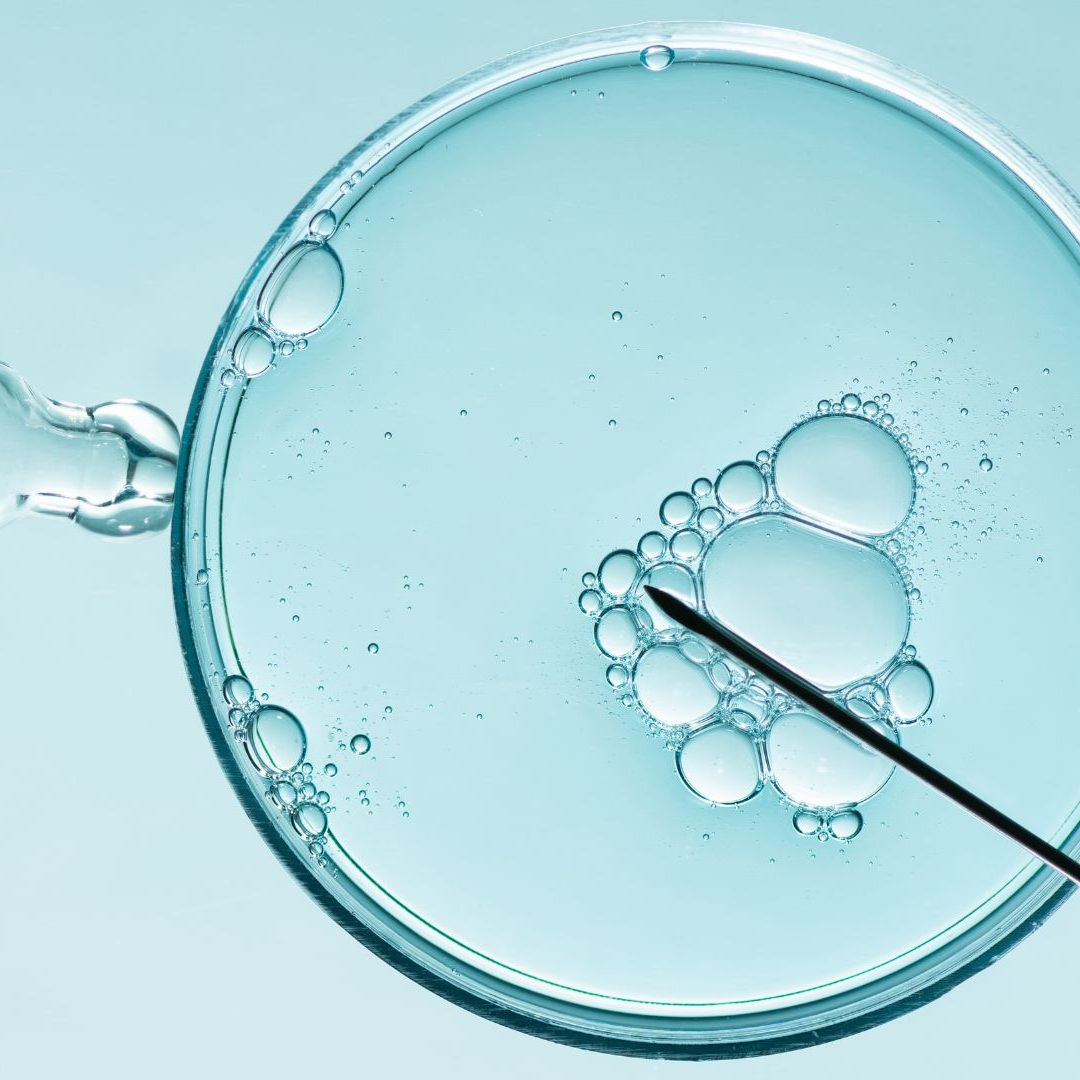 Eine Frau wurde drei Mal mit Fremdsperma befruchtet - ohne davon zu wissen.