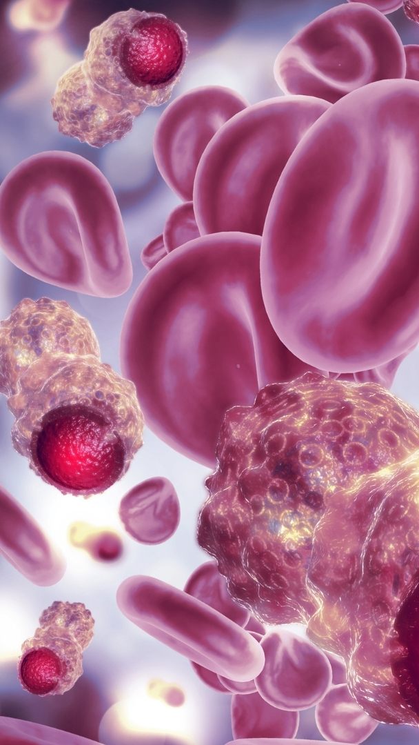 Forscher entdeckten ein Protein, das das Wachstum von Hirntumorzellen deutlich verlangsamt.