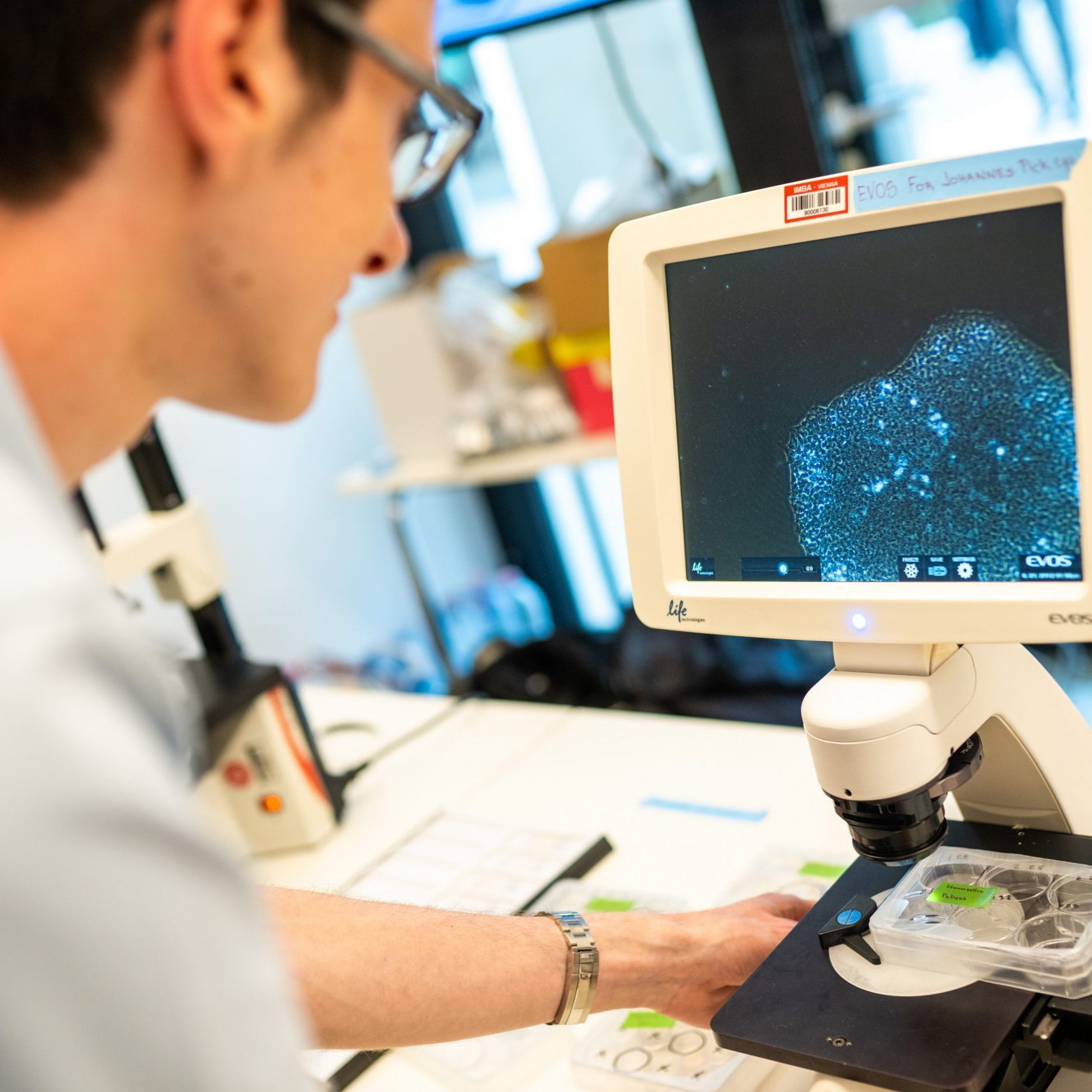 Stammzellen können laut Studie Hirn nach Schlaganfall heilen.