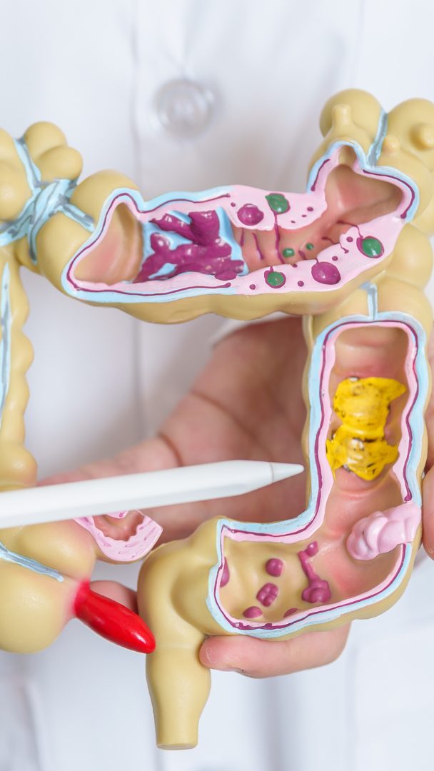 Alarmierender Trend: Blinddarmkrebs trifft immer öfter Junge