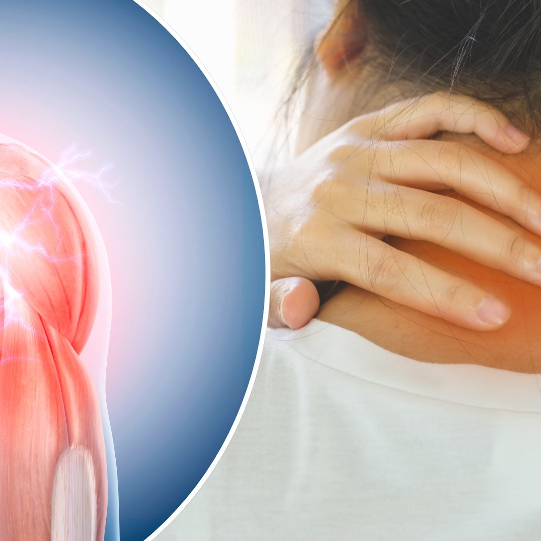 Vom Ziehen zur Erholung: So bekämpfen Sie Muskelkater richtig