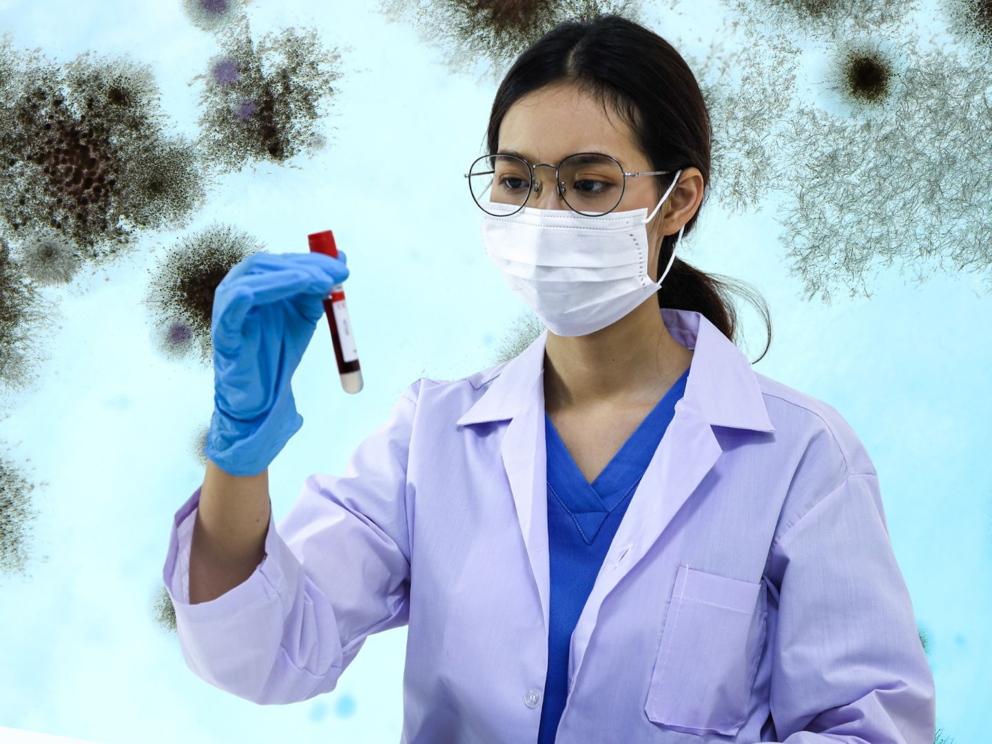 Candida auris ist weltweit auf dem Vormarsch Candida auris ist weltweit auf dem Vormarsch