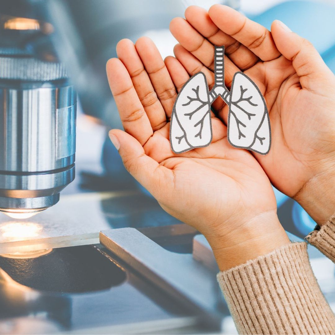 Die Med Uni Graz erforscht die möglichen Ursachen einer Lungenkrebs-Erkrankung.