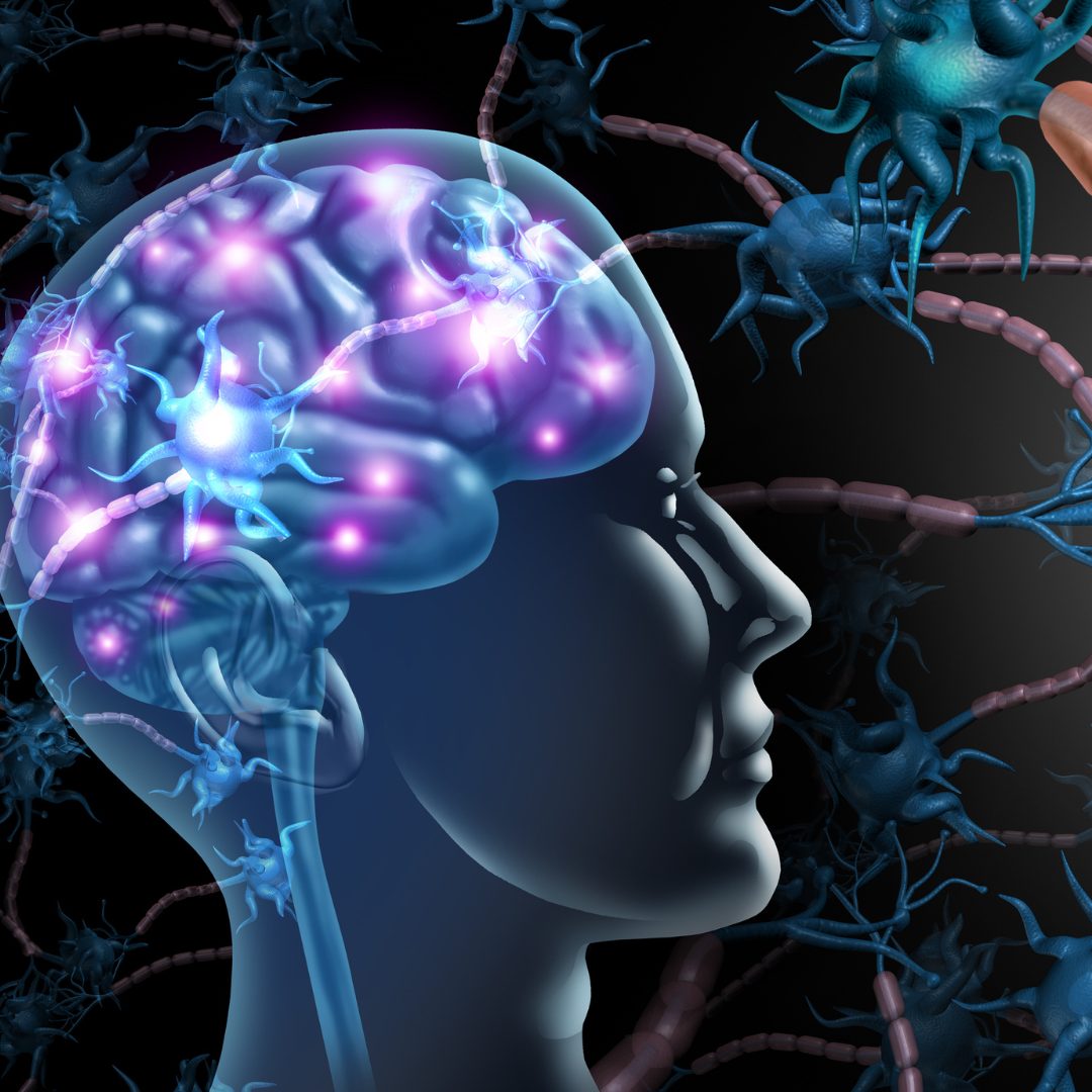 Entscheidungen entstehen im Gehirn nicht Schritt für Schritt, sondern parallel in vielen Regionen.