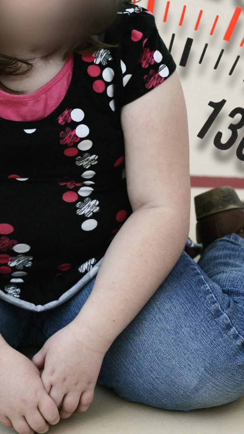 Übergewicht bei Kindern