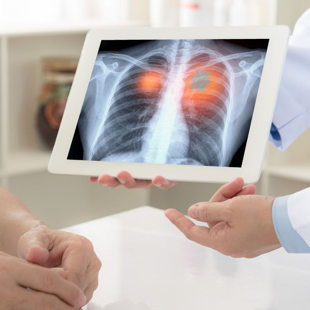 Frühe Diagnose – gute Prognose.