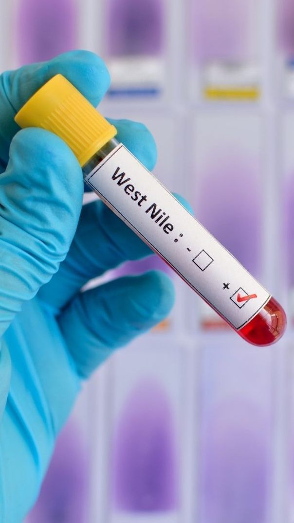 In Griechenland sind sieben Menschen am West-Nil-Virus gestorben.