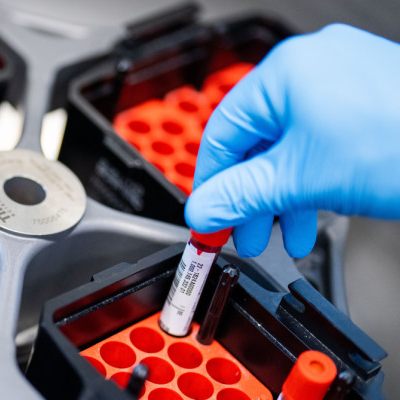 PTX-3-Spiegel bei Betroffenen zehn Wochen nach Infektion stark erhöht