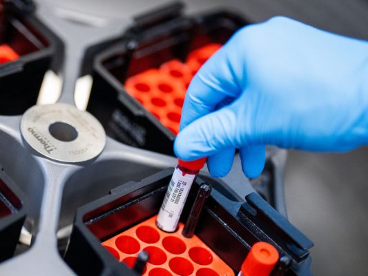 PTX-3-Spiegel bei Betroffenen zehn Wochen nach Infektion stark erhöht