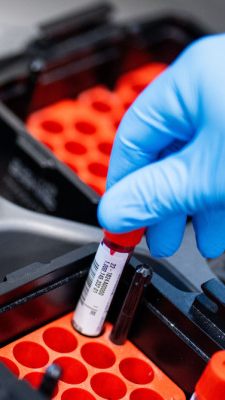 PTX-3-Spiegel bei Betroffenen zehn Wochen nach Infektion stark erhöht