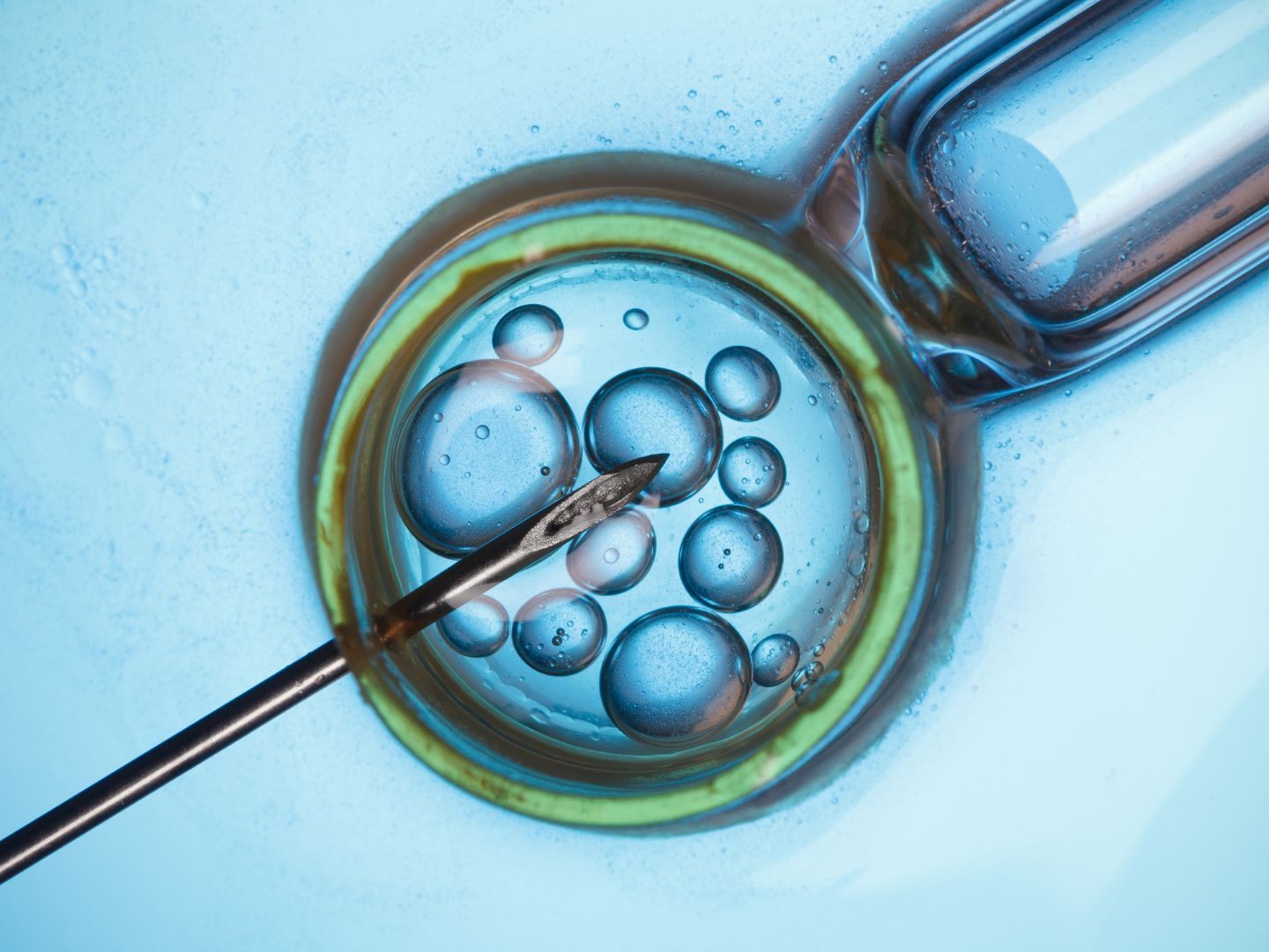 Das Verbot von "Social Egg Freezing" ist laut VfGH verfassungswidrig. Das Verbot von "Social Egg Freezing" ist laut VfGH verfassungswidrig.