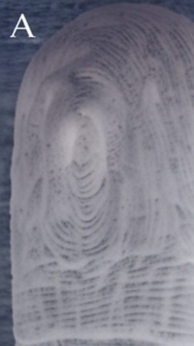 Die drei Aufnahmen zeigen dieselbe Fingerkuppe einer Testperson: (A) vor dem Wasserbad, (B) nach 30 Minuten Wasserexposition, (C) nach erneutem Wasserbad 24 Stunden später. Das Schrumpelmuster bildet sich nahezu identisch aus.