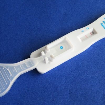 Im Verdachtsfall Test und eventuell schnelle Behandlung angeraten