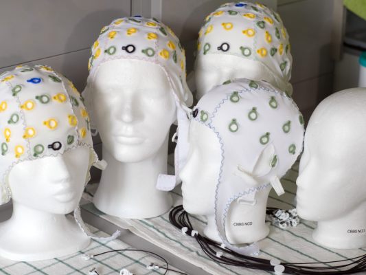 Gehirnstruktur-durchl-uft-f-nf-Phasen