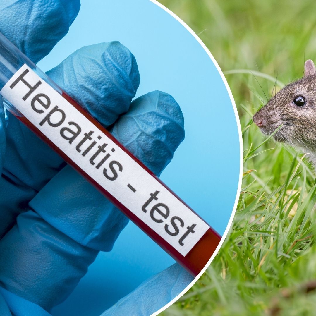 Seltene Hepatitis-E-Variante bei Mann entdeckt