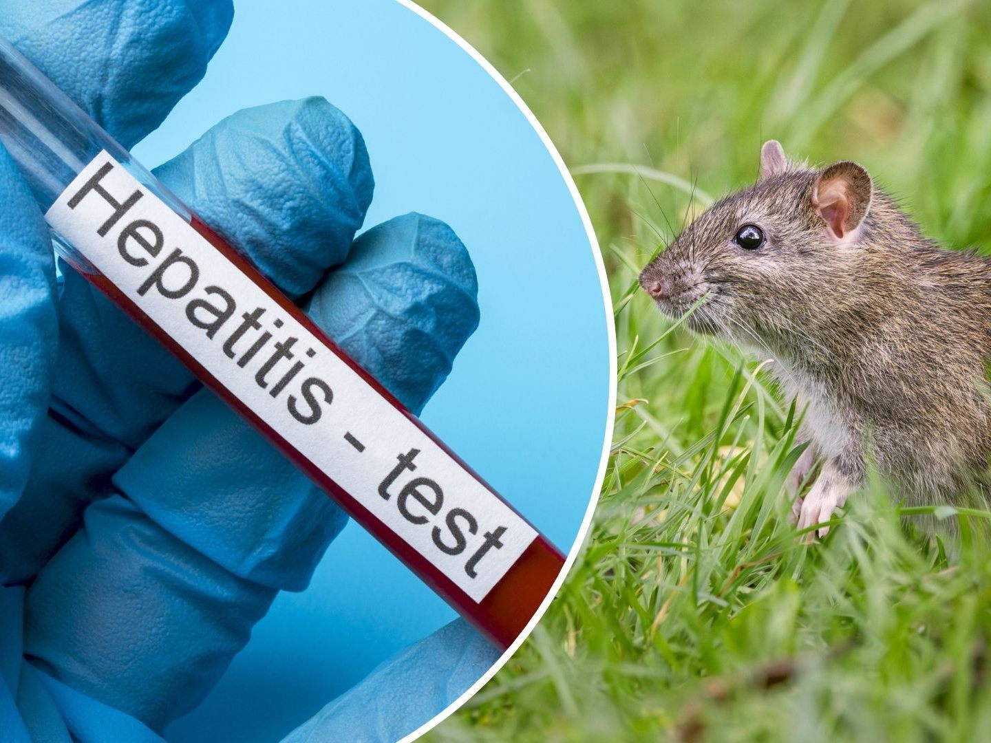 Seltene-Hepatitis-E-Variante-bei-Mann-entdeckt