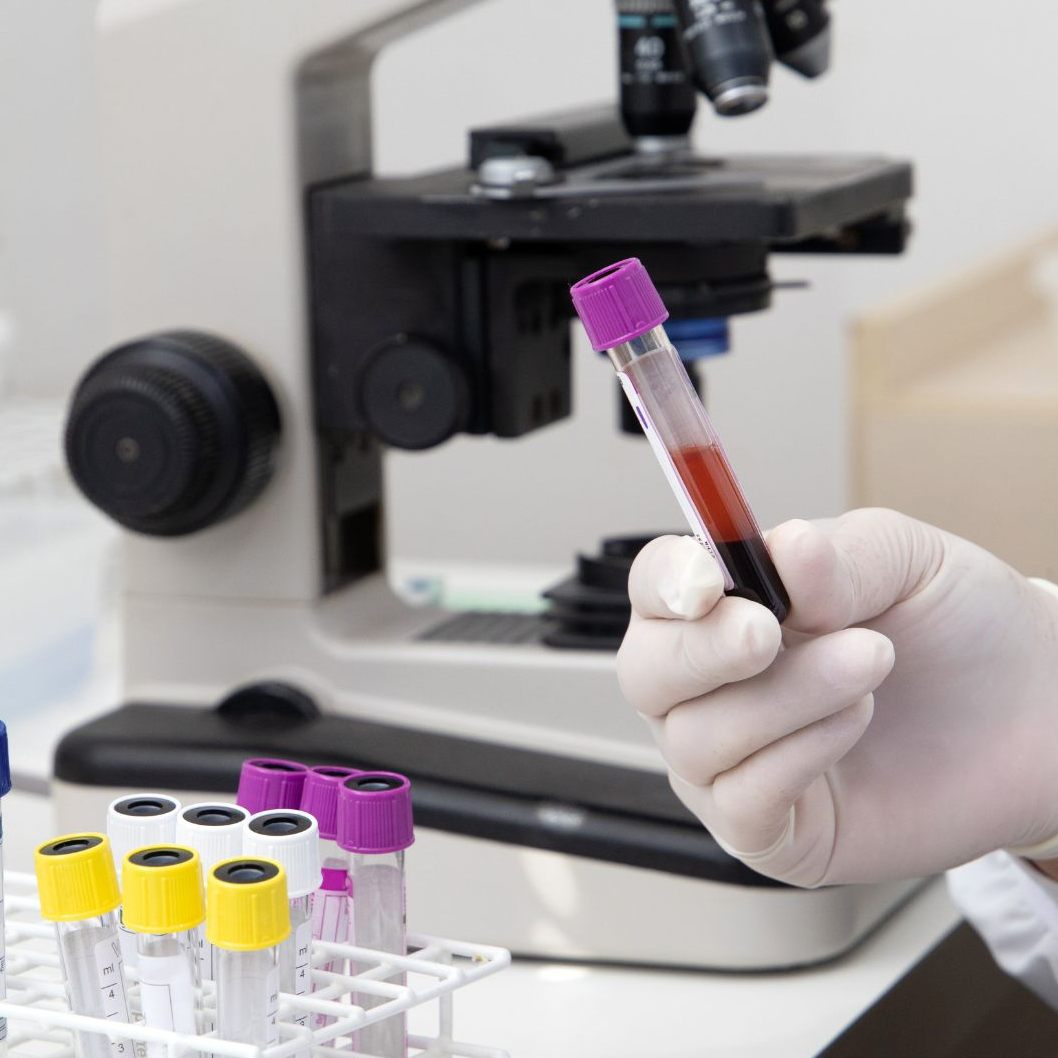 In Tschechien sind in diesem Jahr bereits 28 Menschen an einer Hepatitis-A-Infektion gestorben.