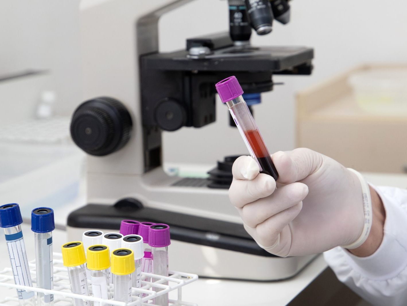 In Tschechien sind in diesem Jahr bereits 28 Menschen an einer Hepatitis-A-Infektion gestorben.