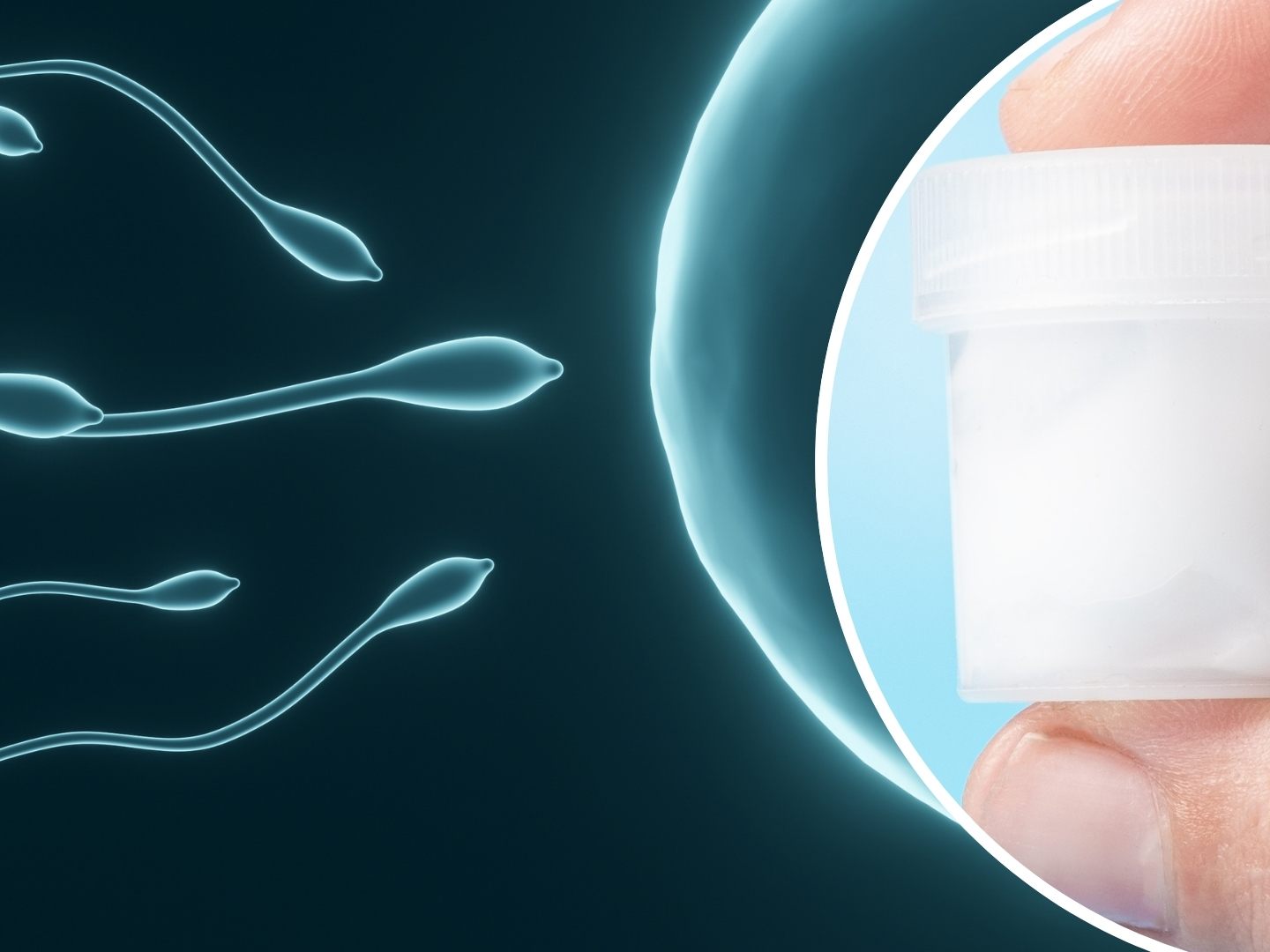 das-gef-hrliche-gesch-ft-mit-samenspenden-spender-mit-genmutation-zeugte-fast-200-kinder