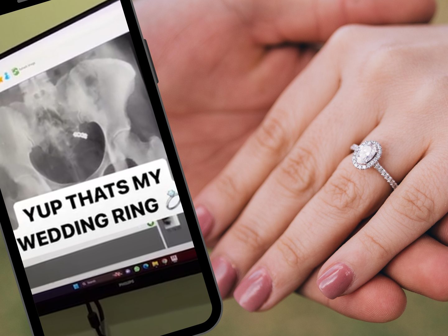 Ehering im Bauch: Kurioser Vorfall im Thailand-Urlaub